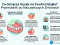 Ilustracja pokazuje różne zmiany na dziąśle, w tym nadziąślak (guzek zapalno-rozrostowy), ropień, włókniak i afty.