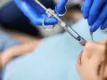 Dentysta podaje znieczulenie miejscowe pacjentowi.