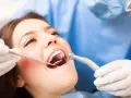 Pacjentka u dentysty, który bada jej usta. Widoczne narzędzia stomatologiczne i zaczerwienione dziąsło, sugerujące ropne zapalenie dziąseł.