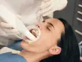 Dentysta bada zęby pacjentki, która używa specjalnej pasty na ruszające się zęby.