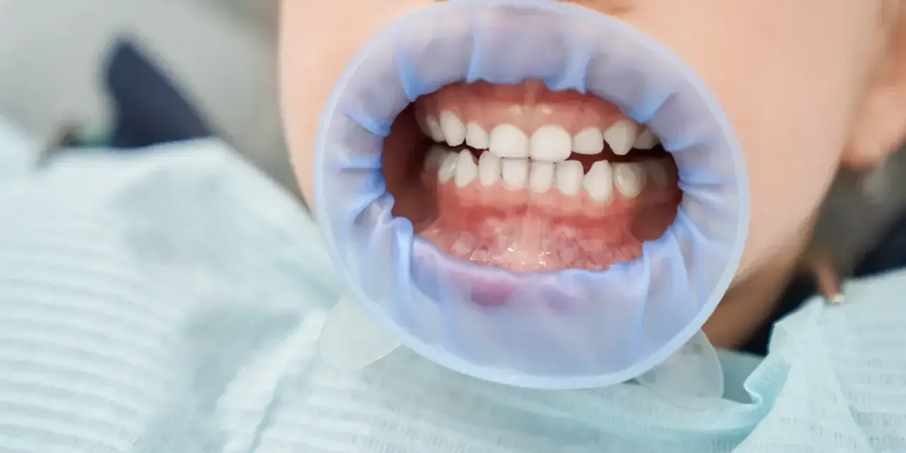 Uśmiechnięte siekacze u dziecka, gotowe na wizytę u dentysty.