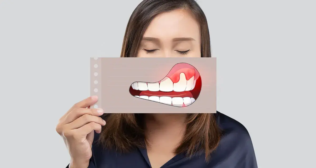Kobieta trzyma kartkę z rysunkiem zębów i zaczerwienionych dziąseł, symbolizując zapalenie okostnej.