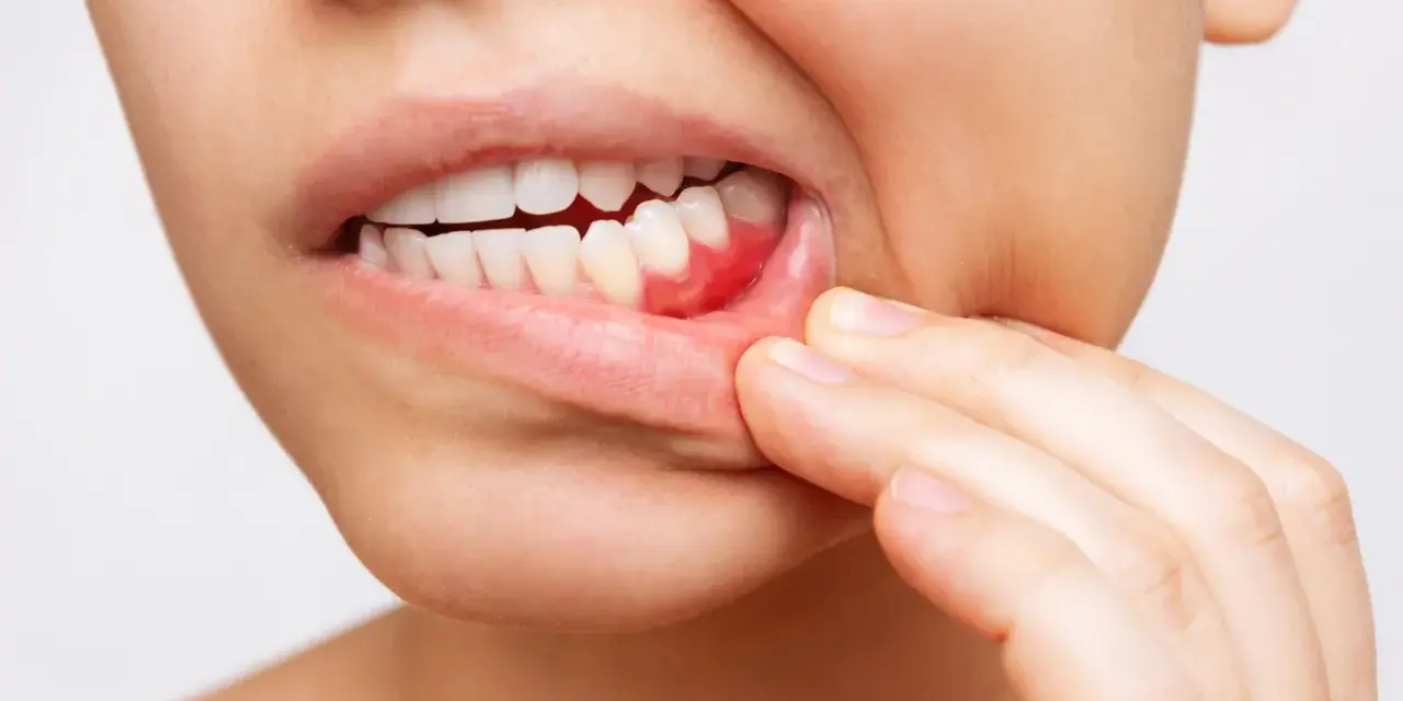 Widoczne białe zęby i zaczerwienione, pulsujące dziąsła, które osoba dotyka palcami.