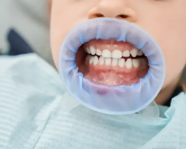 Uśmiechnięte siekacze u dziecka, gotowe na wizytę u dentysty.