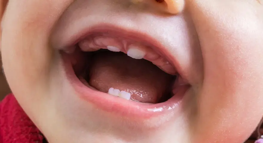 Uśmiechnięte dziecko z widocznymi nowymi ząbkami, które mogą być oznaką nietypowych objawów ząbkowania.